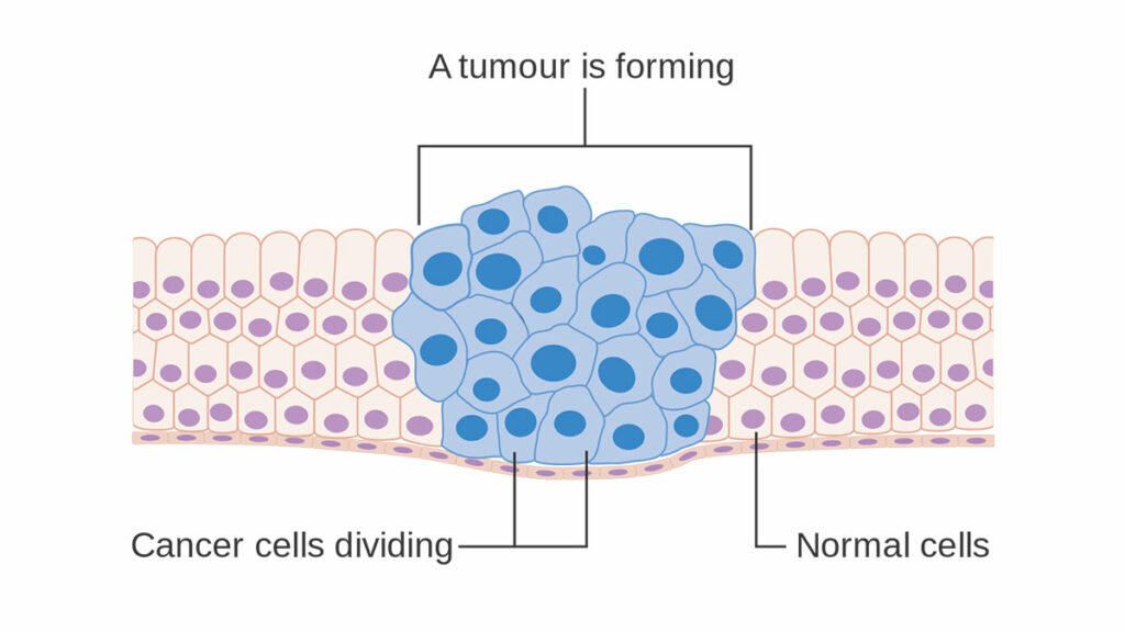 "Diagram showing how cancer cells keep on reproducing to form a tumour." by Cancer Research UK is licensed under CC BY-SA 4.0