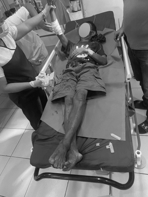 Photo from Negros Occidental Police Provincial Office.